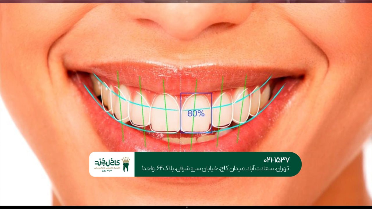 خدمات زیبایی دندان