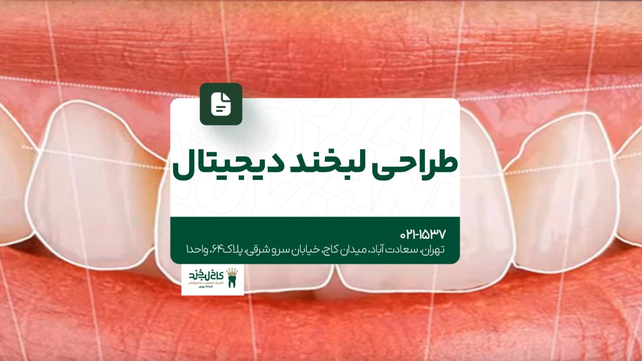 طراحی لبخند دیجیتال