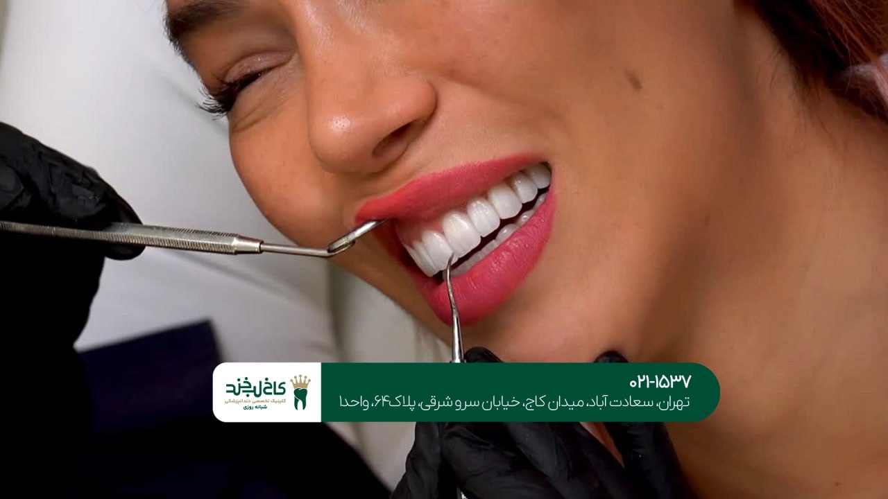 طراحی لبخند دیجیتال