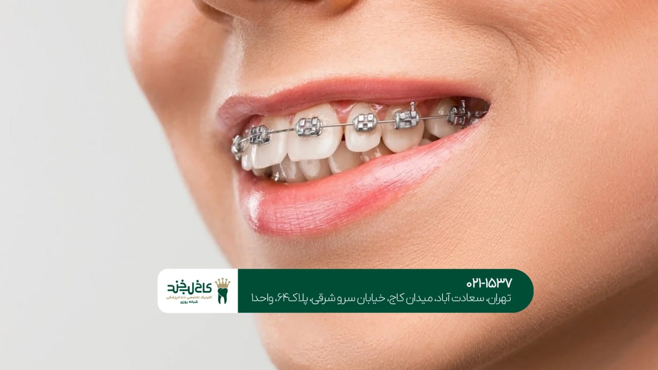 درمانهای زیبایی دهان و دندان