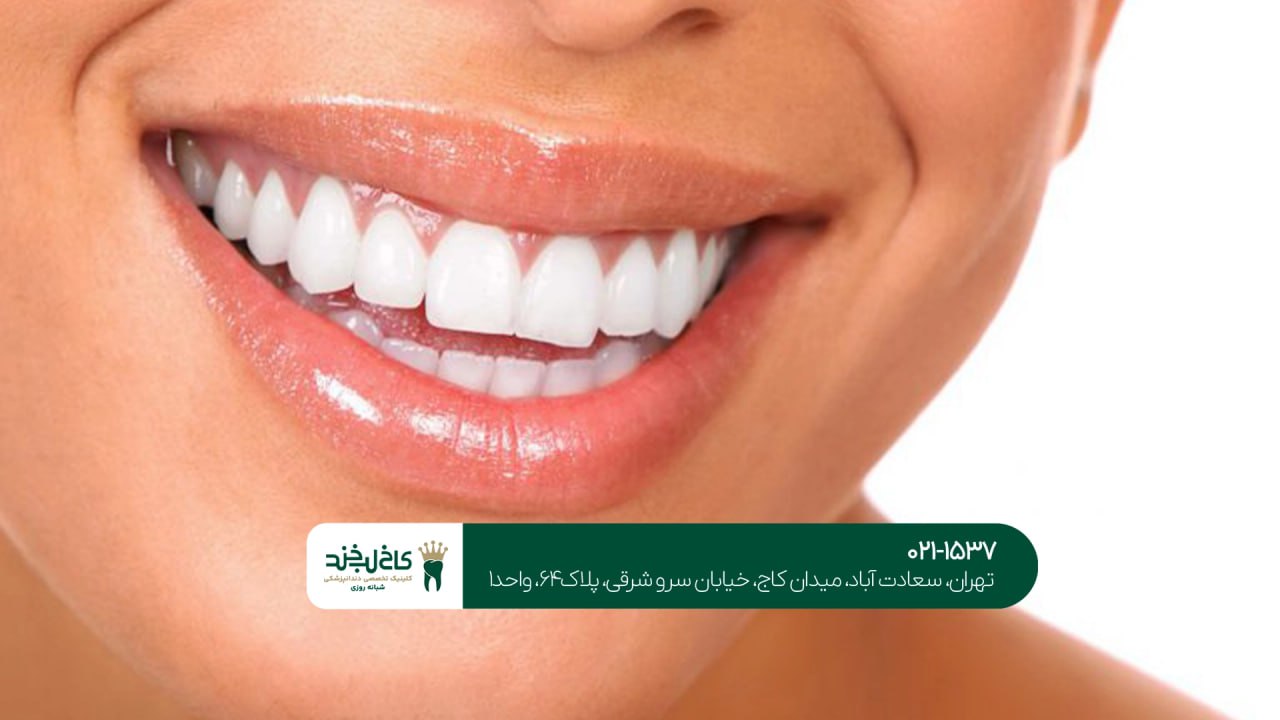 درمانهای زیبایی دهان و دندان