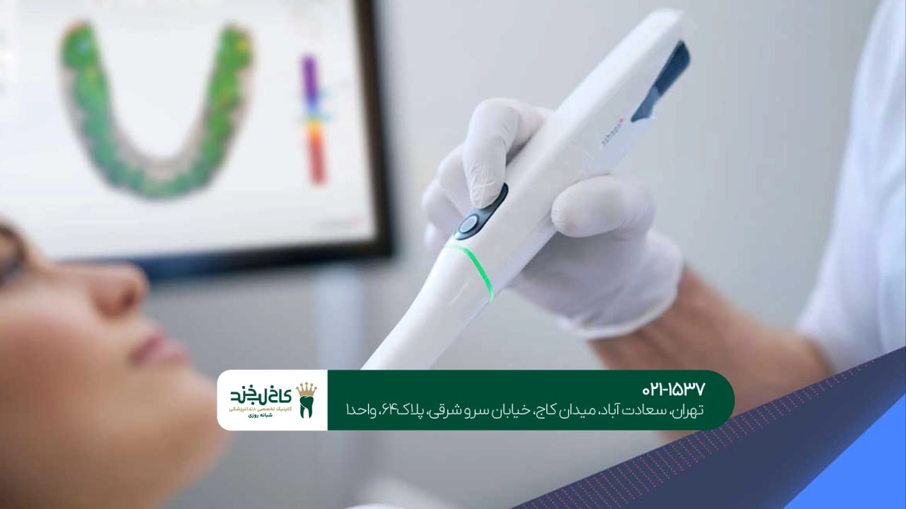 زیبایی دندانها با استفاده از تکنولوژی پیشرفته
