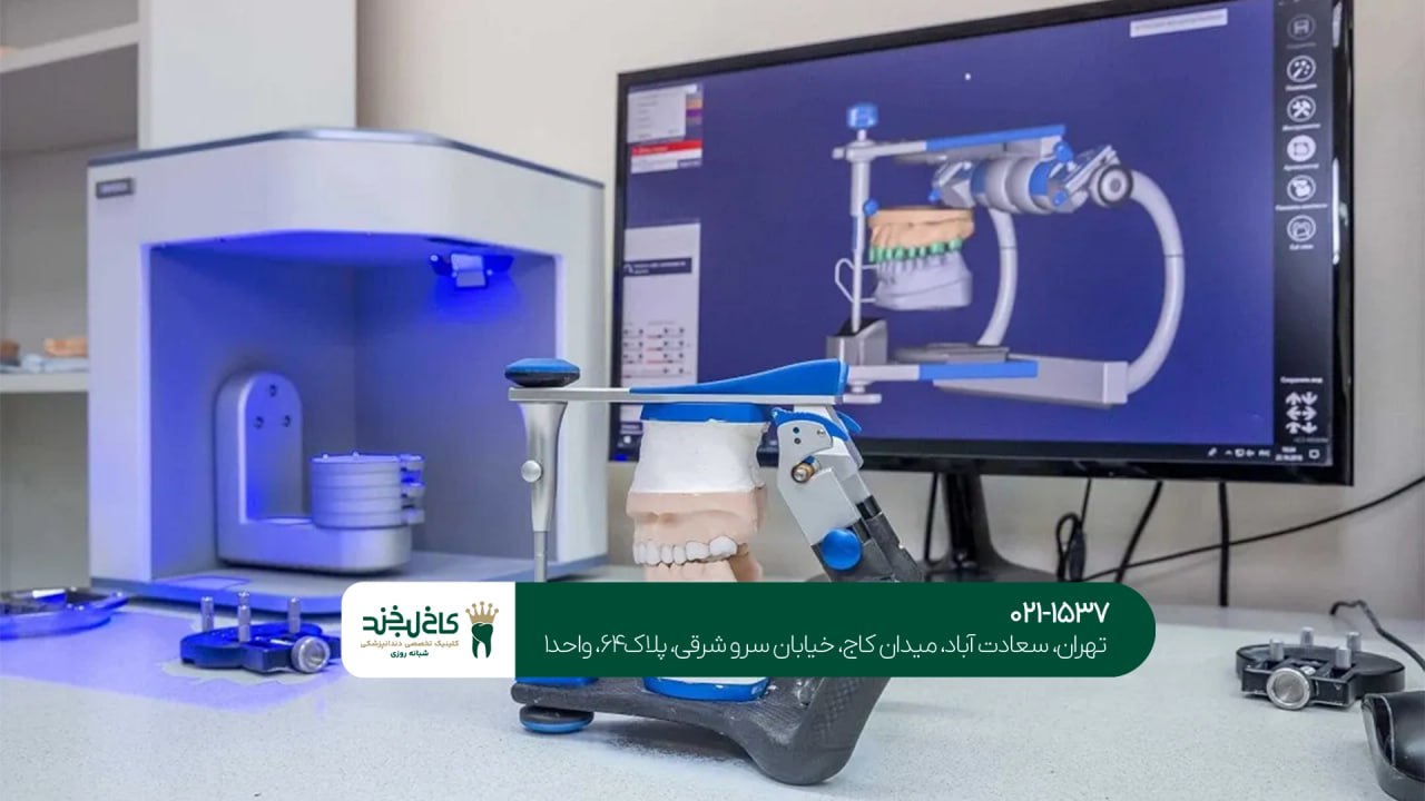 زیبایی دندانها با استفاده از تکنولوژی پیشرفته