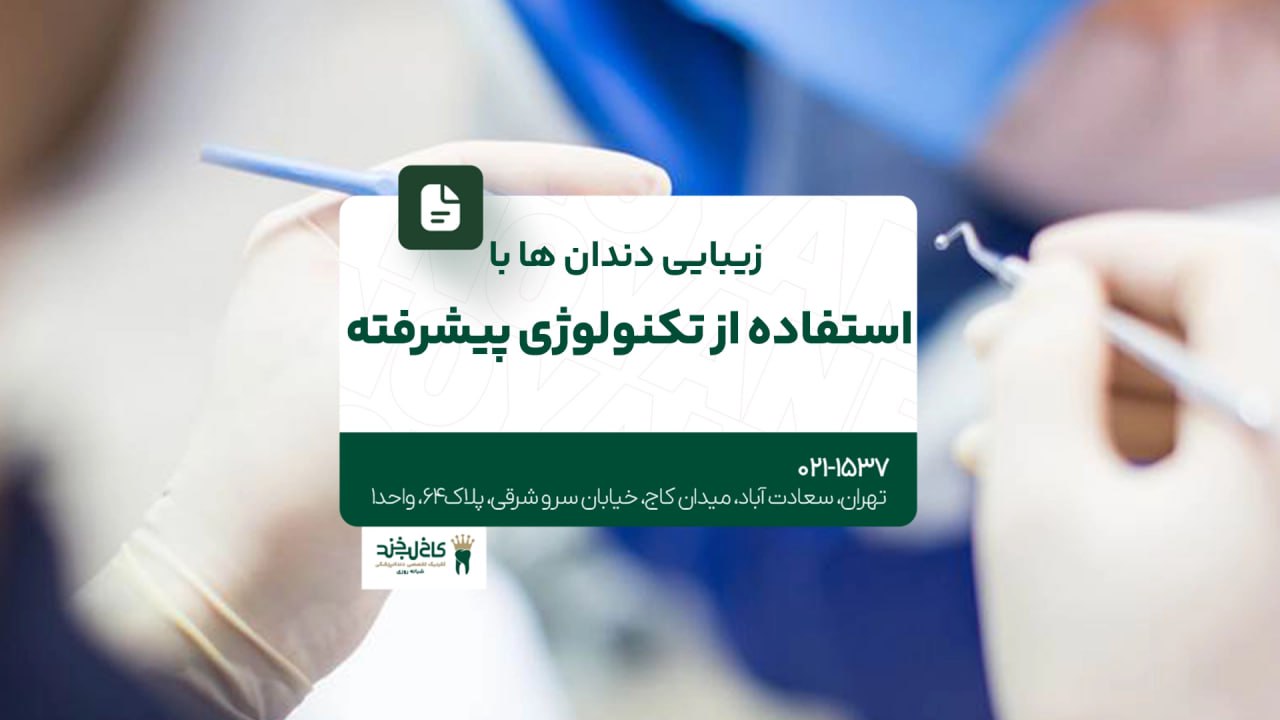 زیبایی دندانها با استفاده از تکنولوژی پیشرفته