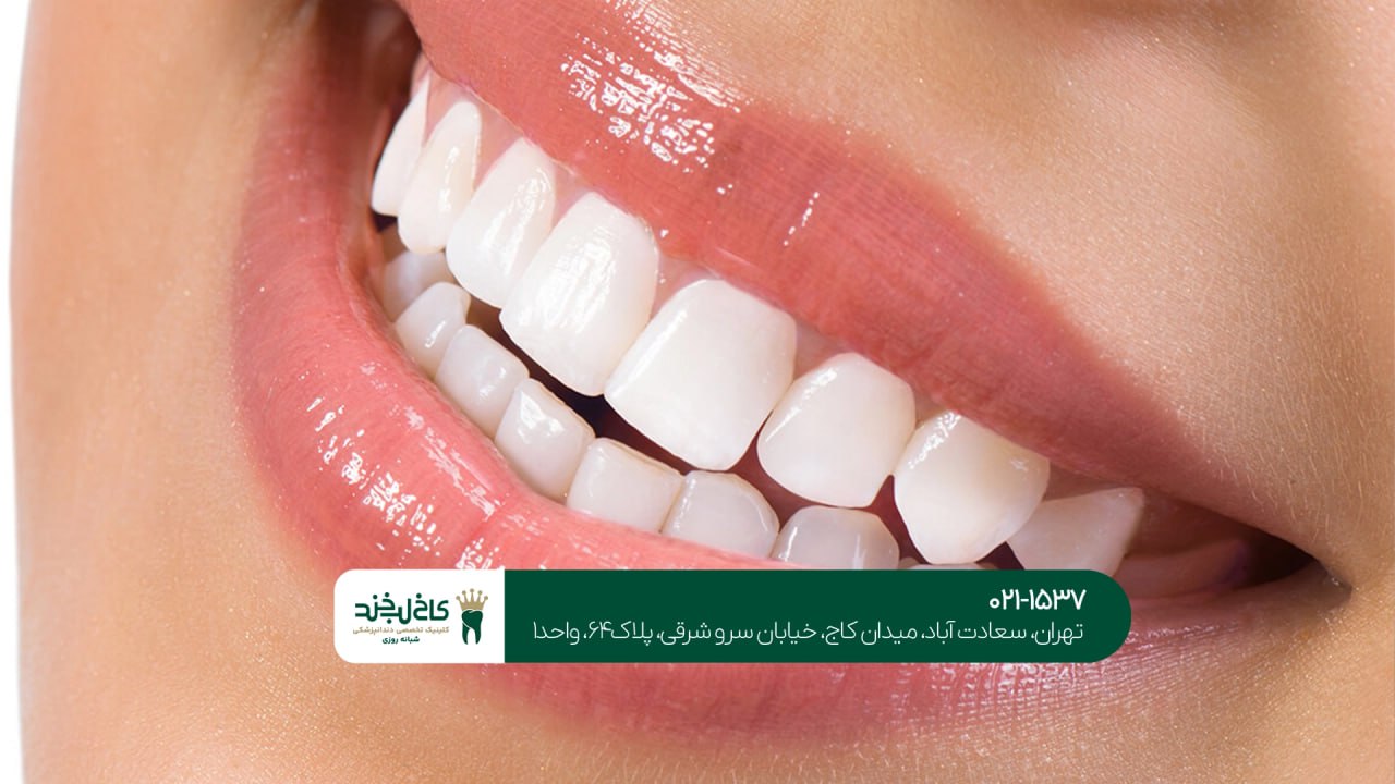 دندانپزشکی زیبایی برای طرح لبخند