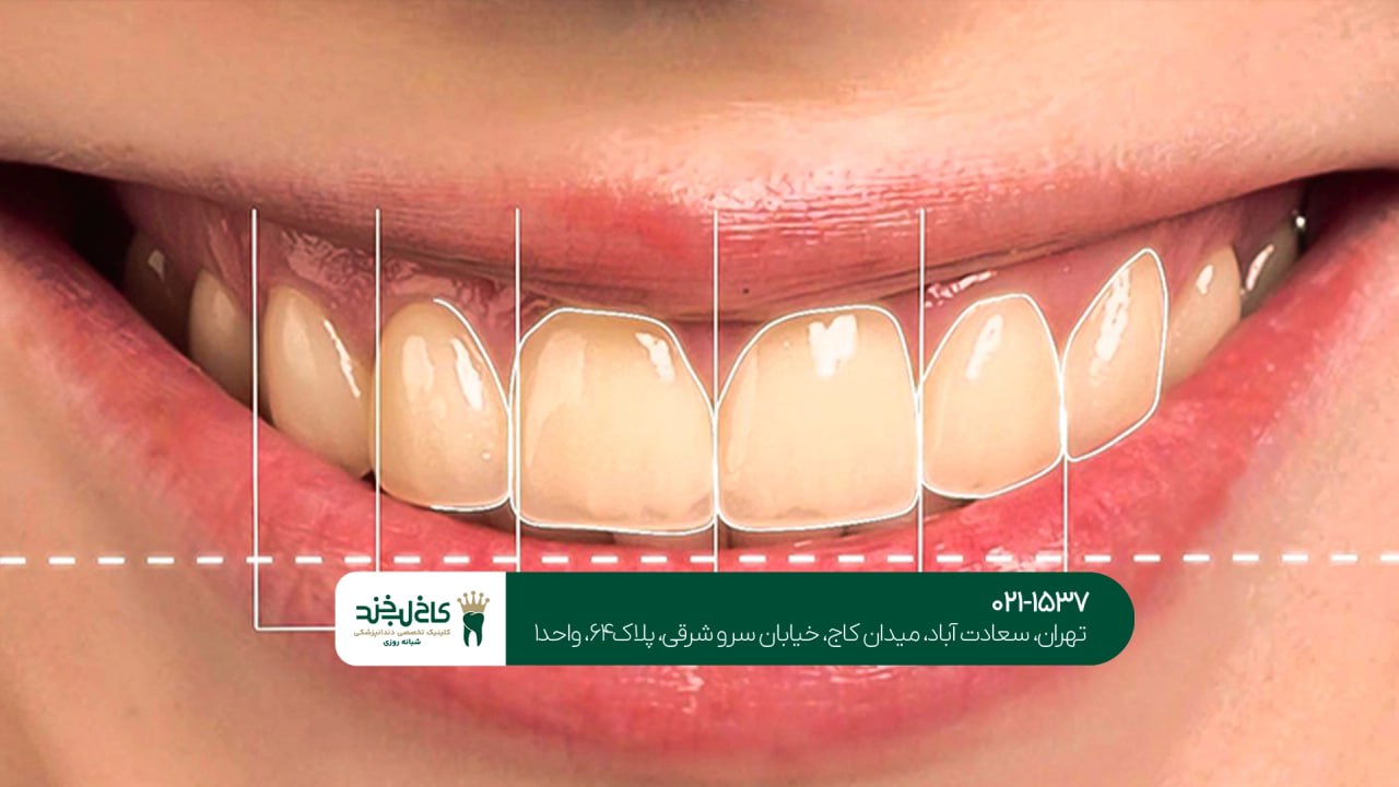 طراحی دیجیتال لبخند به صورت تخصصی