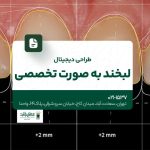 طراحی دیجیتال لبخند به صورت تخصصی