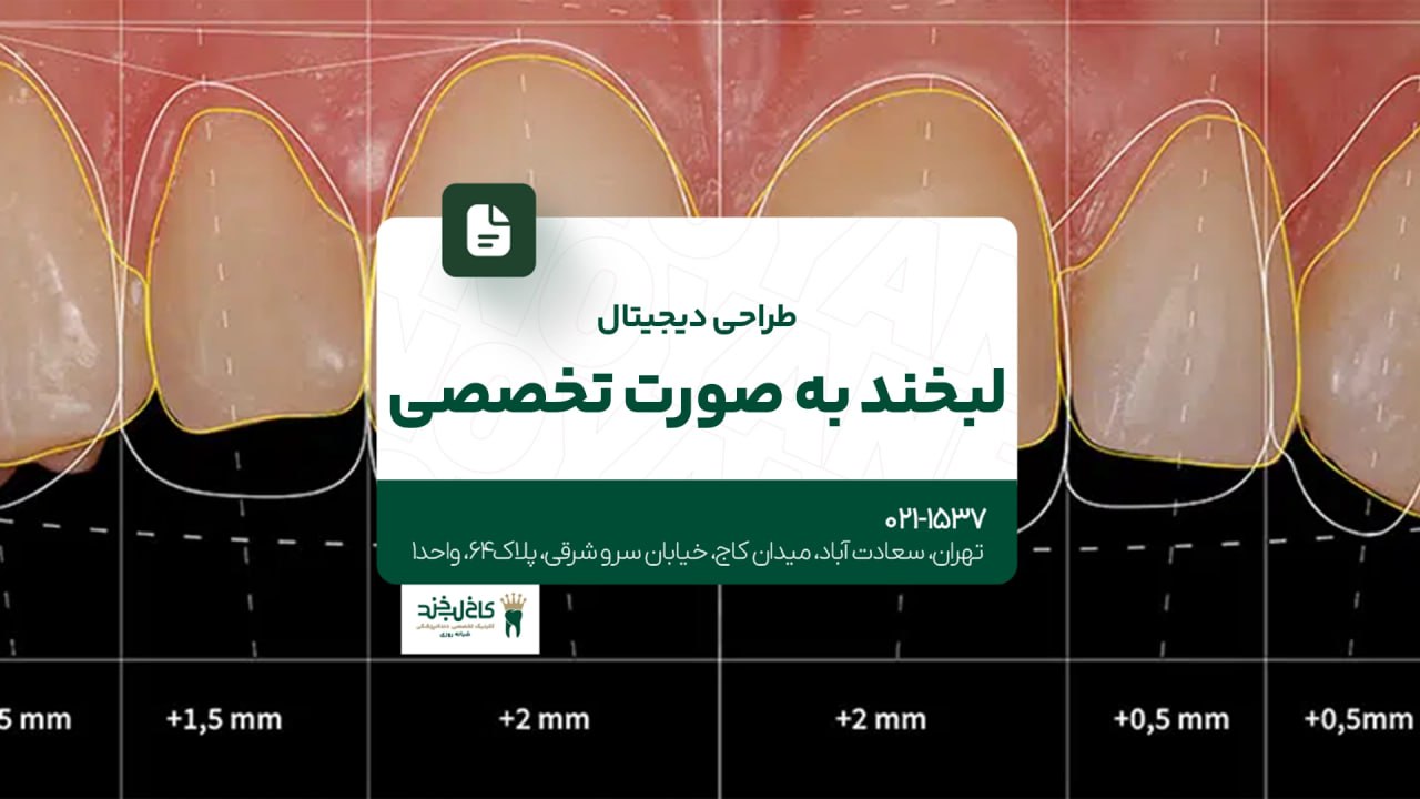 طراحی دیجیتال لبخند به صورت تخصصی