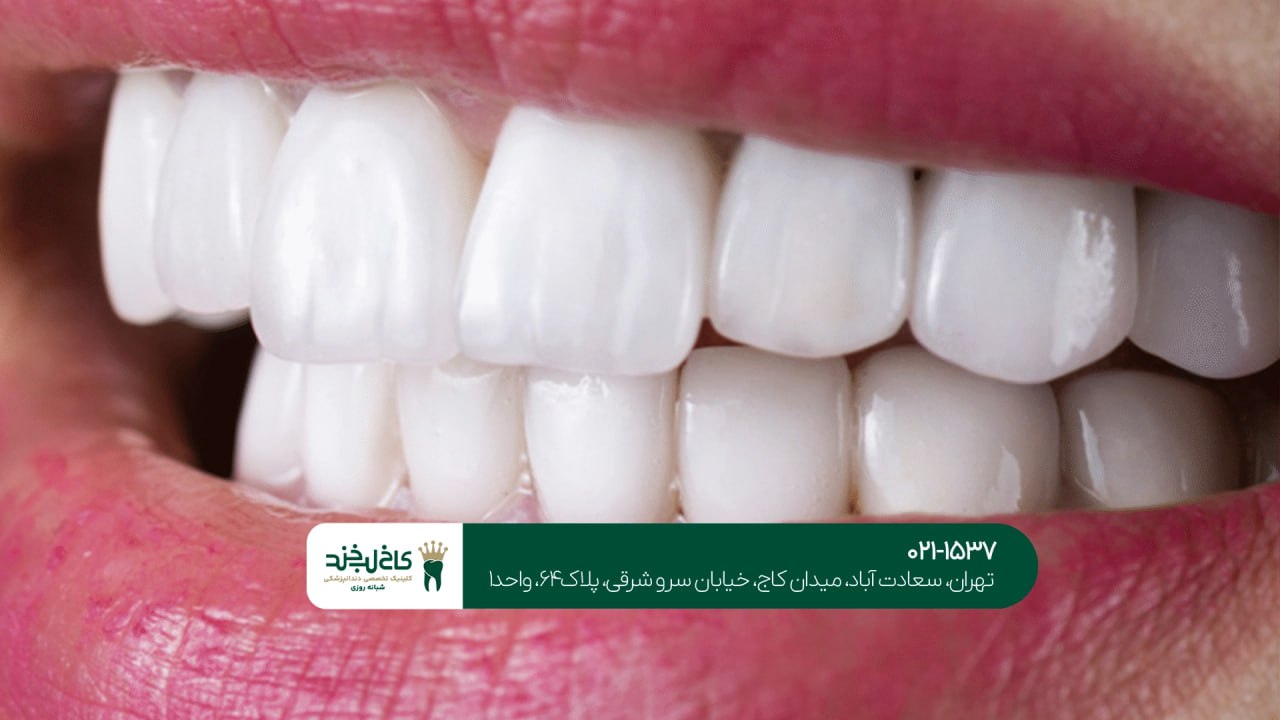 درمان زیبایی دندان با قیمت مناسب