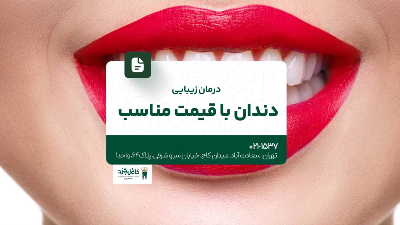 درمان زیبایی دندان با قیمت مناسب