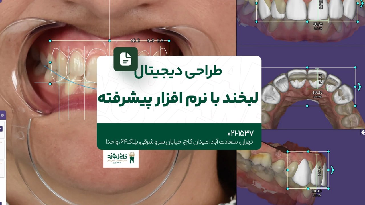 طراحی دیجیتال لبخند با نرمافزار پیشرفته