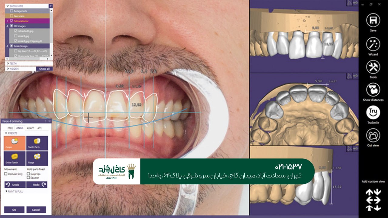 طراحی دیجیتال لبخند با نرمافزار پیشرفته