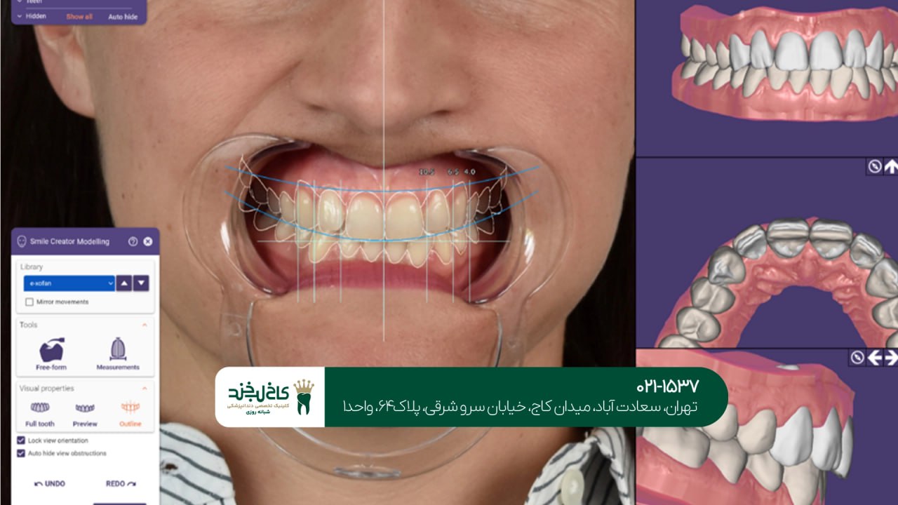 طراحی دیجیتال لبخند با نرمافزار پیشرفته