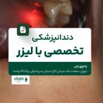 دندانپزشکی تخصصی با لیزر