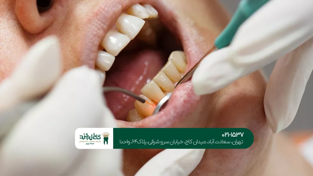 دندانپزشکی تخصصی با لیزر