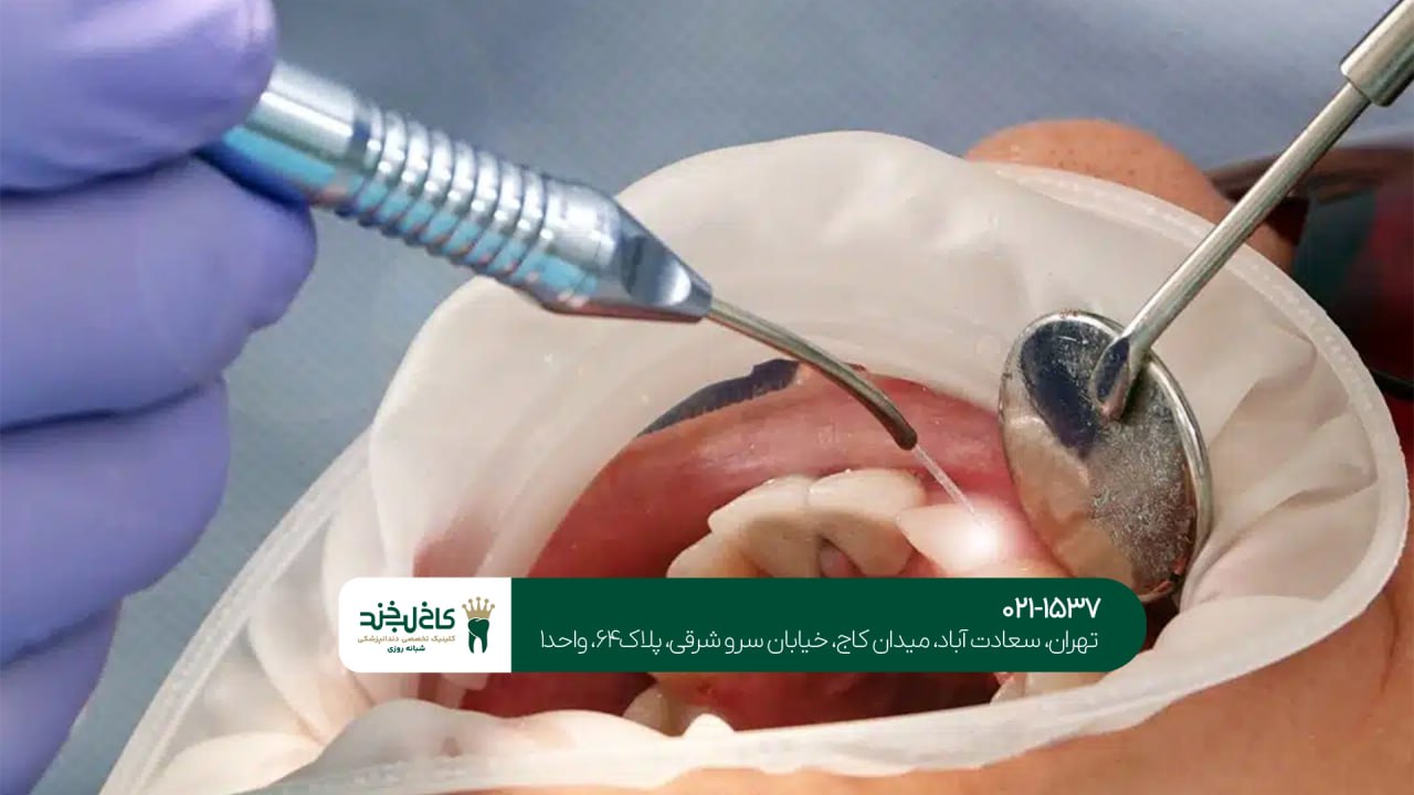 دندانپزشکی تخصصی با لیزر