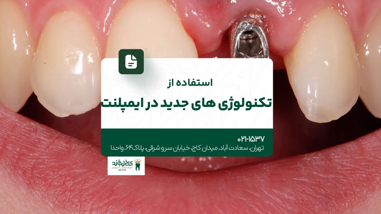 استفاده از تکنولوژیهای جدید در ایمپلنت