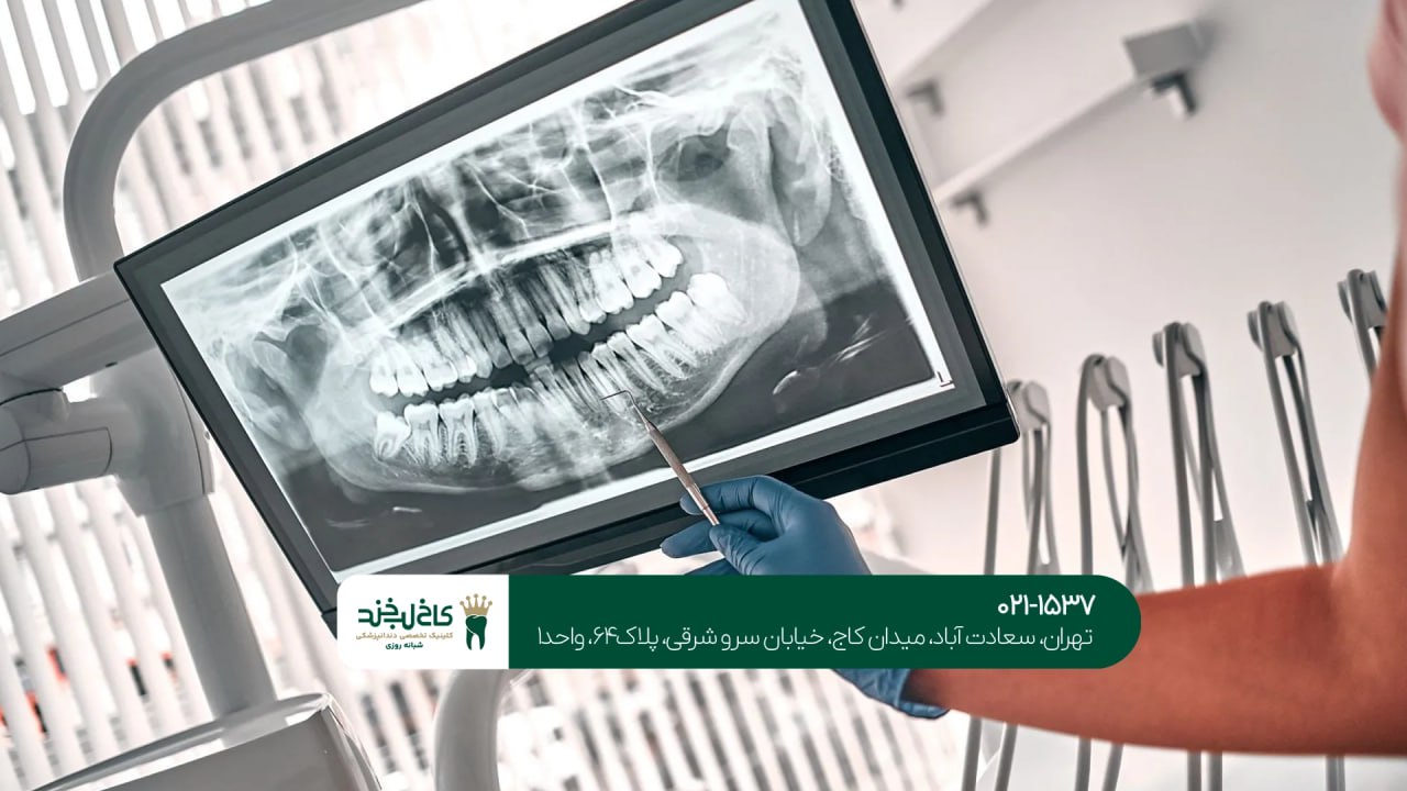 سیستم تصویربرداری دیجیتال در دندانپزشکی