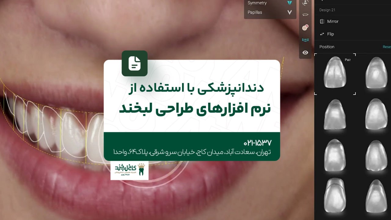 دندانپزشکی با استفاده از نرمافزارهای طراحی لبخند