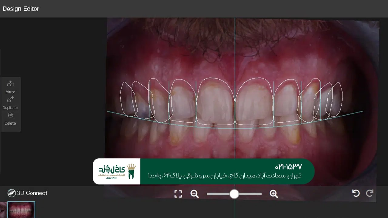 دندانپزشکی با استفاده از نرمافزارهای طراحی لبخند