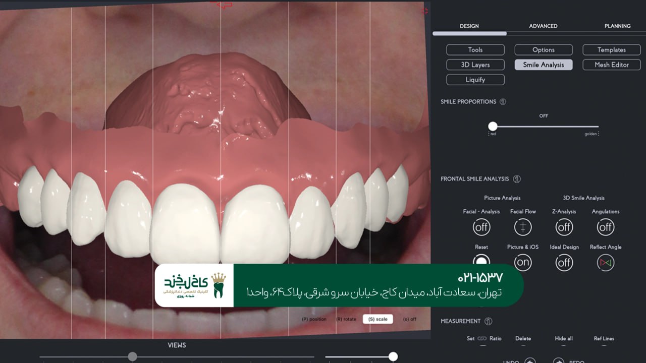 دندانپزشکی با استفاده از نرمافزارهای طراحی لبخند