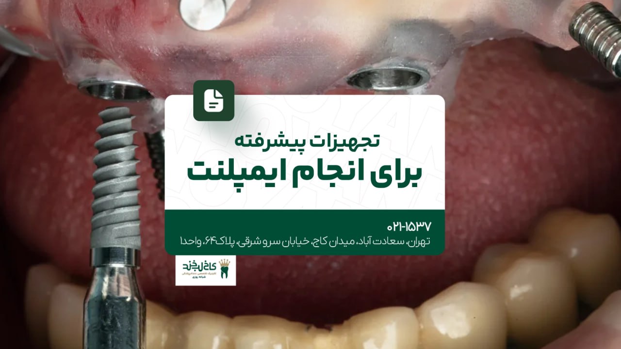 تجهیزات پیشرفته برای انجام ایمپلنت