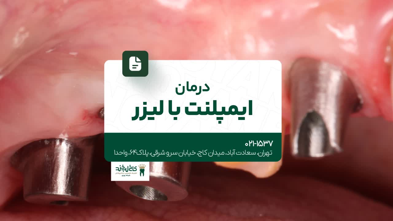 درمان ایمپلنت با لیزر