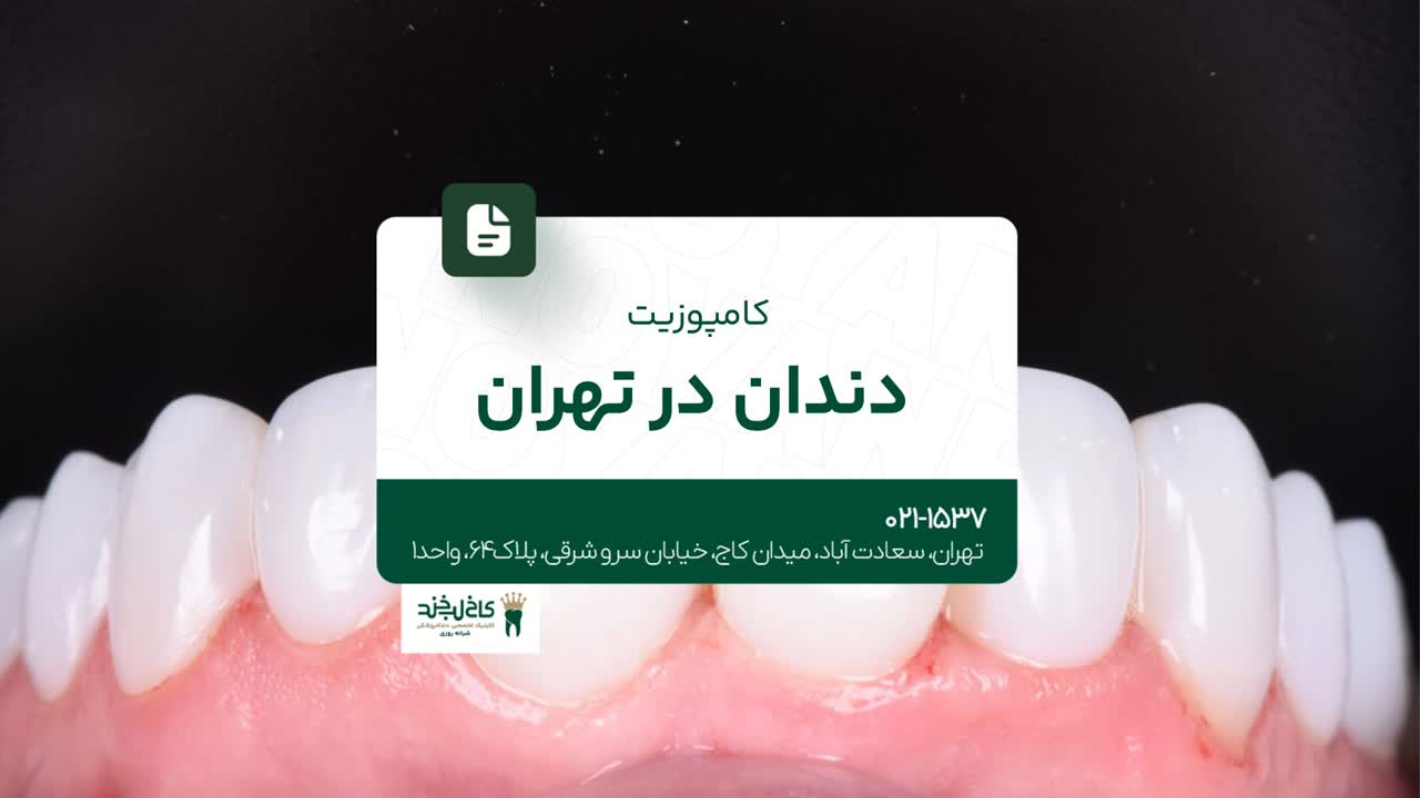 کامپوزیت دندان در تهران کامپوزیت دندان در تهران