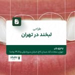 طراحی لبخند در تهران