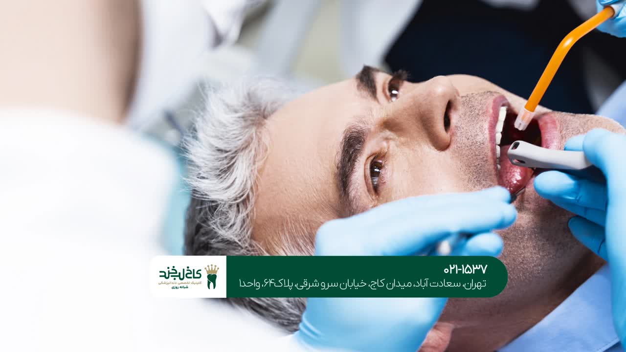 درمان ریشه دندان درمان ریشه دندان