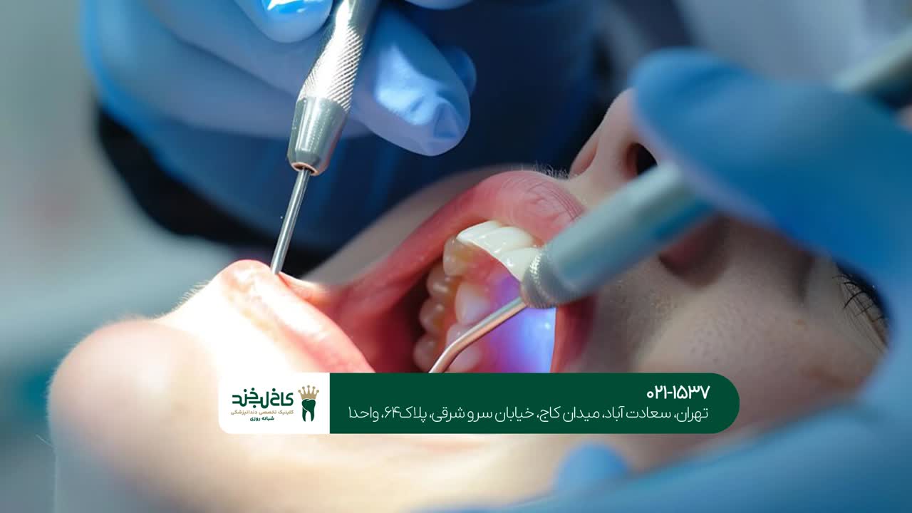 هزینه خدمات تخصصی درمان ریشه در تهران هزینه خدمات تخصصی درمان ریشه در تهران