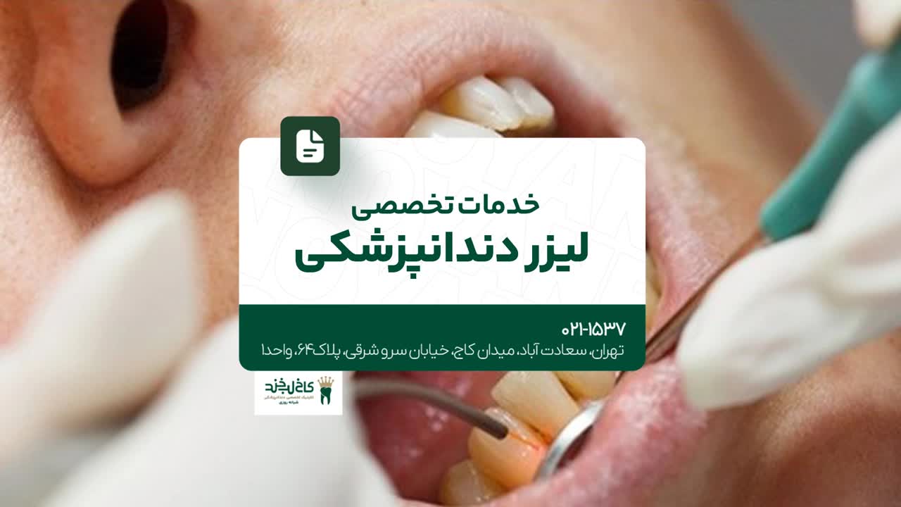 خدمات تخصصی لیزر دندانپزشکی خدمات تخصصی لیزر دندانپزشکی