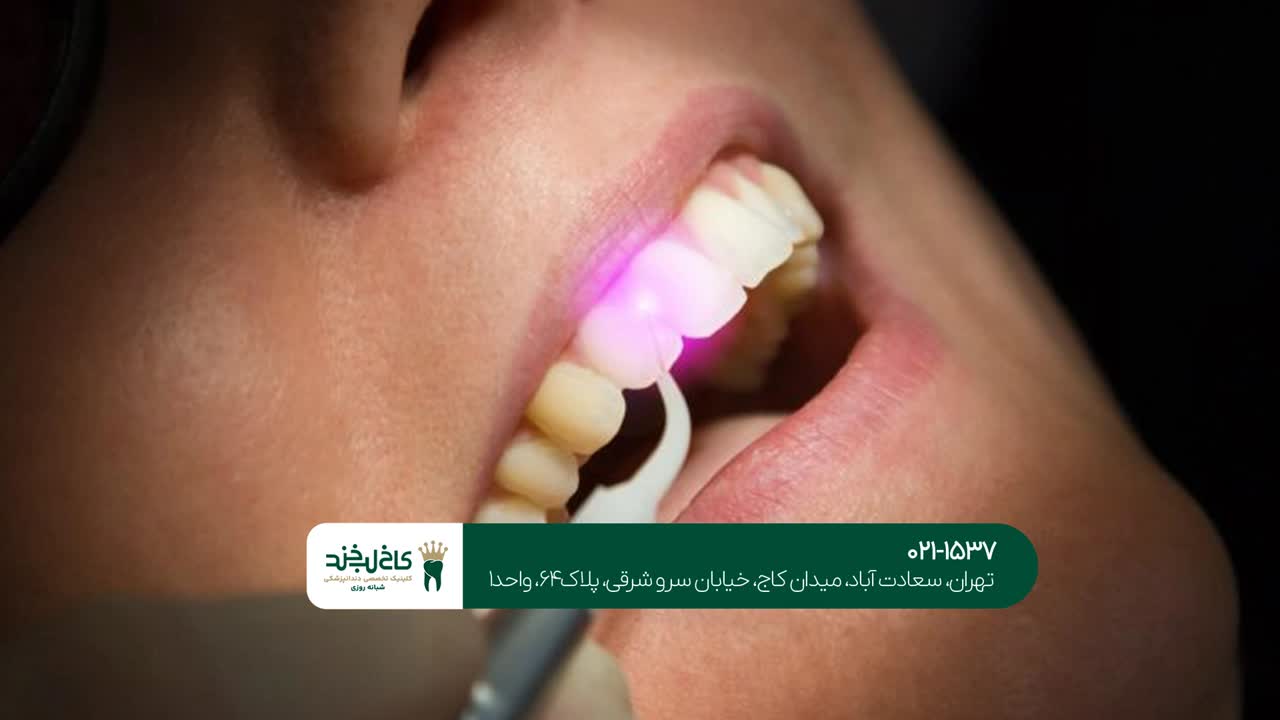 مزایای خدمات تخصصی لیزر دندانپزشکی مزایای خدمات تخصصی لیزر دندانپزشکی