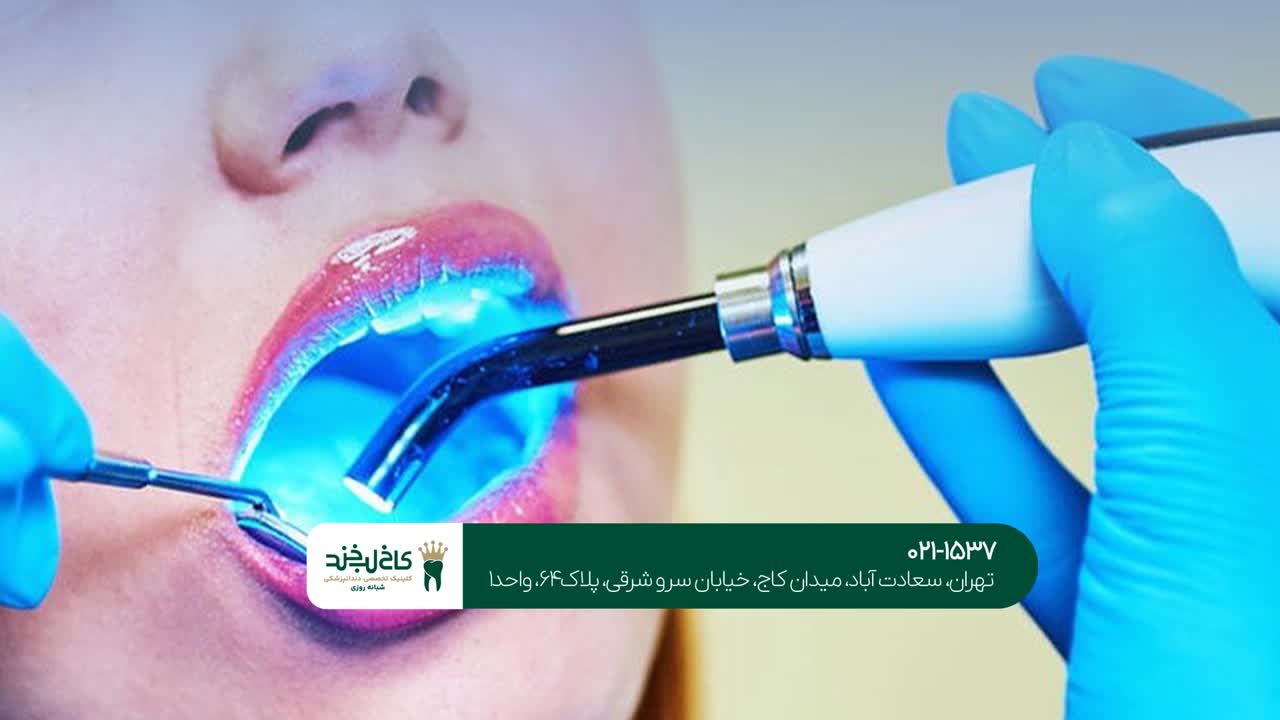 کاربرد لیزر دندانپزشکی کاربرد لیزر دندانپزشکی
