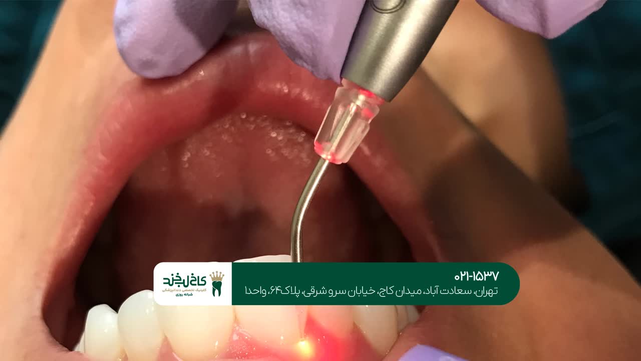 خدمات تخصصی لیزر با شرایط اقساطی خدمات تخصصی لیزر با شرایط اقساطی