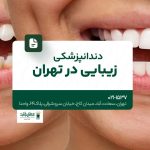 دندانپزشکی زیبایی در تهران