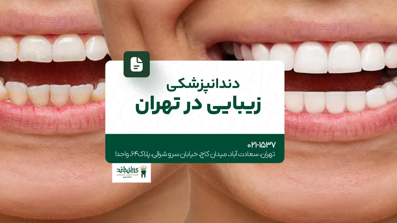 دندانپزشکی زیبایی در تهران دندانپزشکی زیبایی در تهران