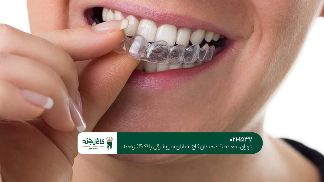 خدمات دندانپزشکی زیبایی خدمات دندانپزشکی زیبایی