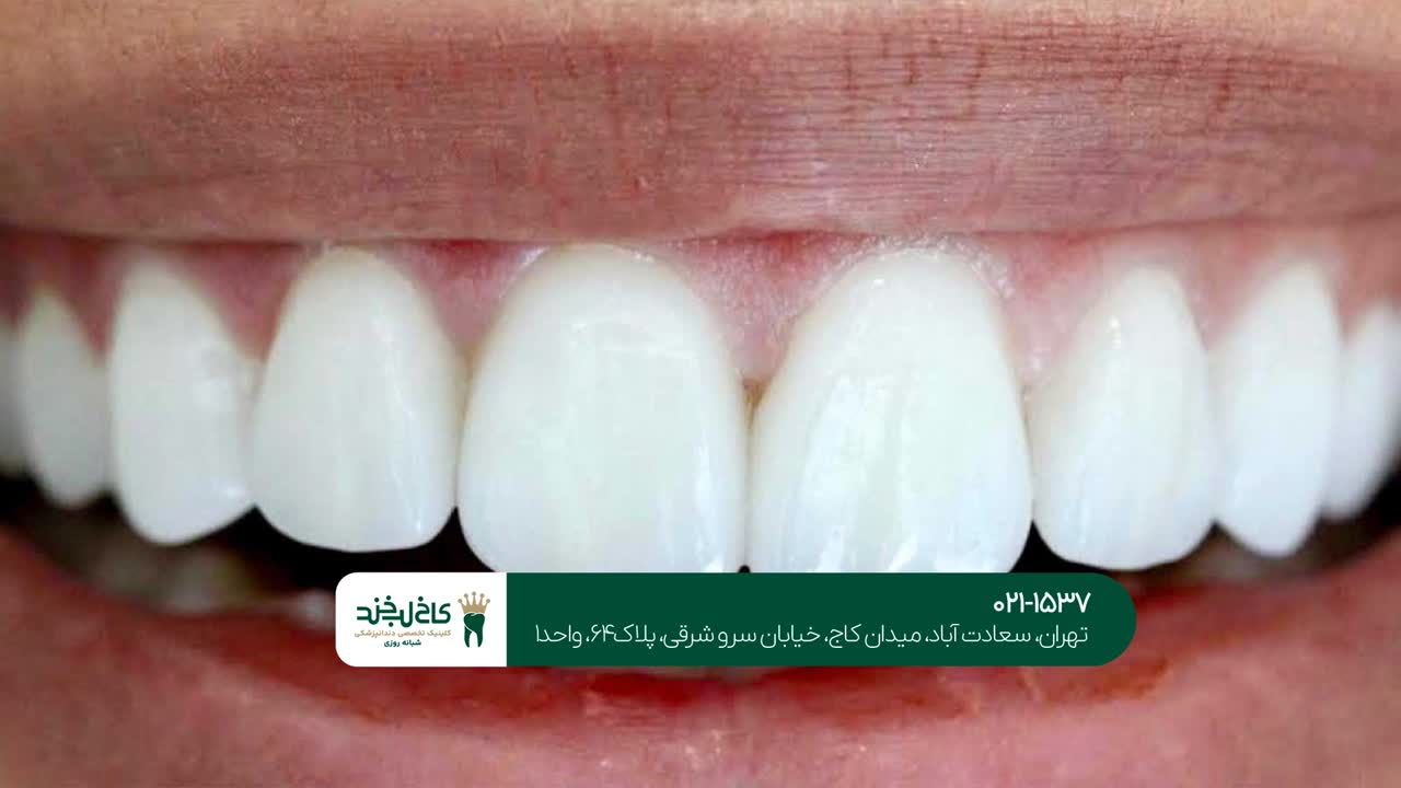 دندانپزشکی زیبایی دندانپزشکی زیبایی