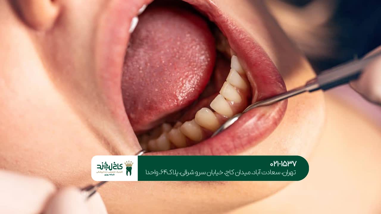 بهترین کلینیک دندانپزشکی در تهران بهترین کلینیک دندانپزشکی در تهران