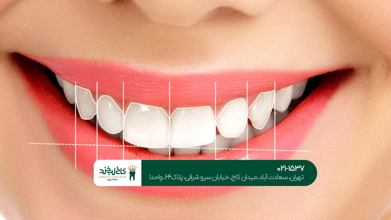 بهترین مرکز طراحی دیجیتال لبخند بهترین مرکز طراحی دیجیتال لبخند