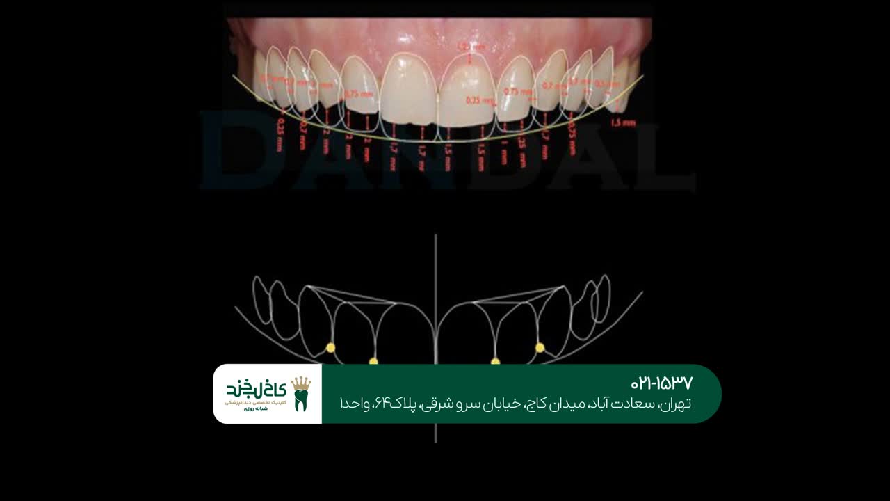 طراحی دیجیتال لبخند در تهران طراحی دیجیتال لبخند در تهران