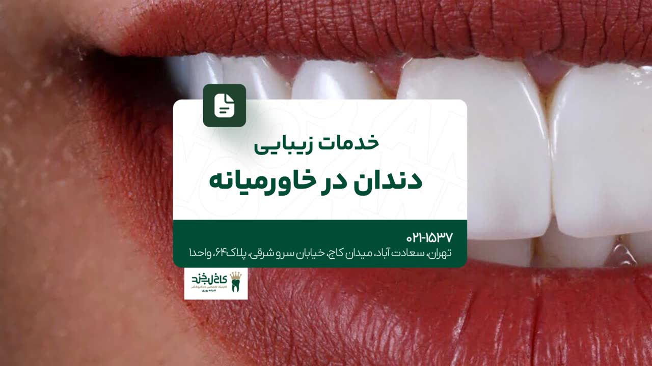 خدمات زیبایی دندان در خاورمیانه خدمات زیبایی دندان در خاورمیانه