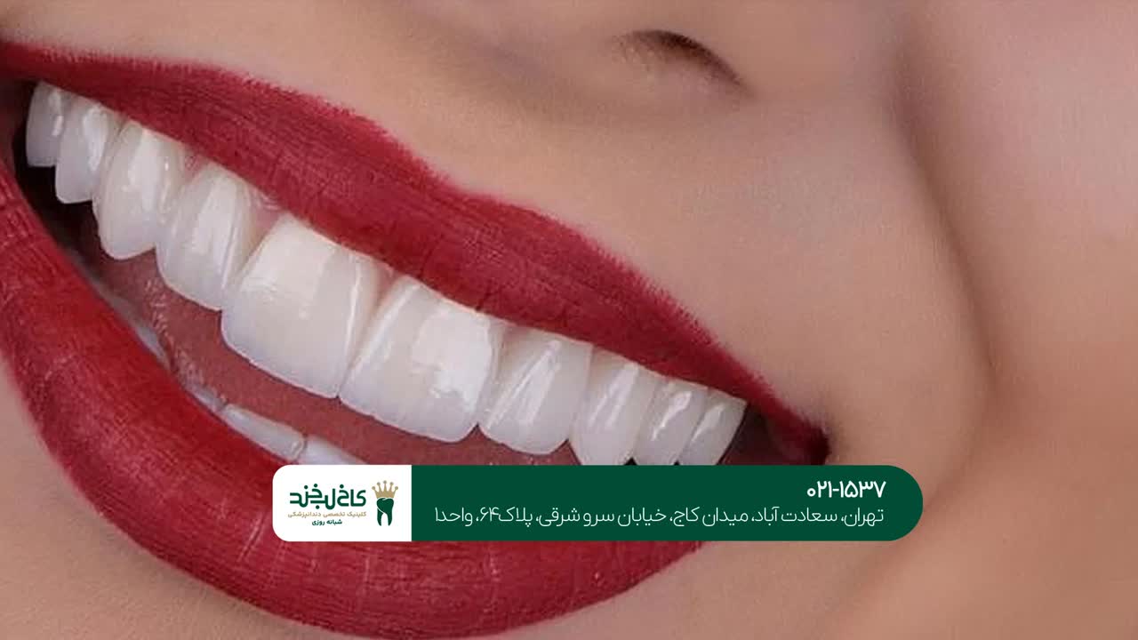 خدمات زیبایی دندان خدمات زیبایی دندان
