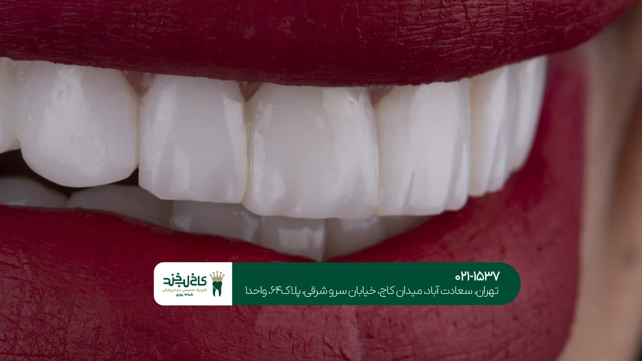 هزینه خدمات زیبایی دندان هزینه خدمات زیبایی دندان