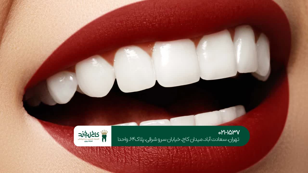 بهترین کلینیک زیبایی دندان در تهران بهترین کلینیک زیبایی دندان در تهران