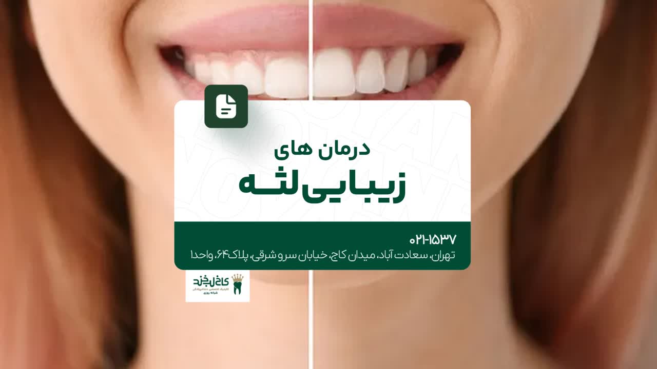 درمان های زیبایی لثه درمان های زیبایی لثه