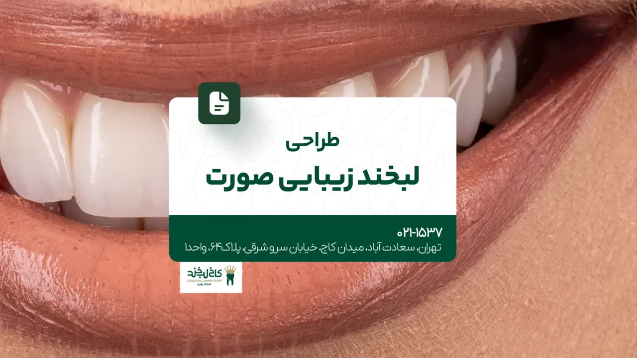 طراحی لبخند و زیبایی صورت طراحی لبخند و زیبایی صورت