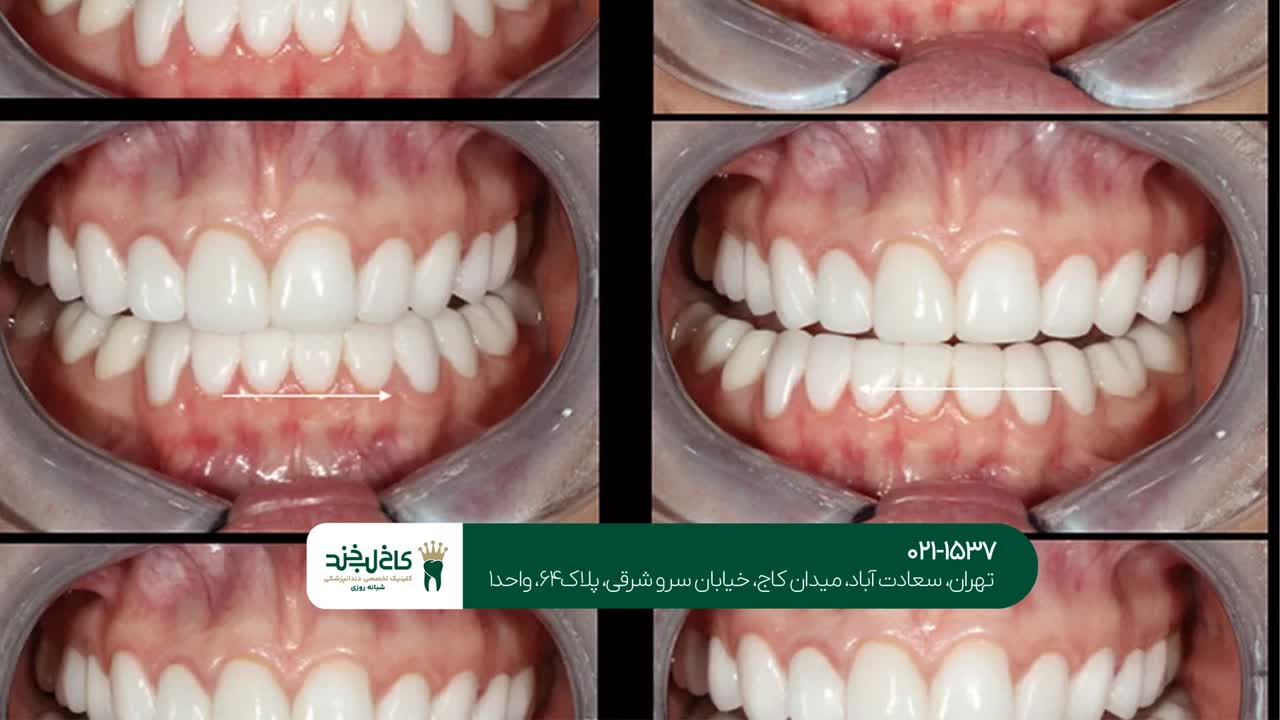 طراحی لبخند دیجیتال طراحی لبخند دیجیتال