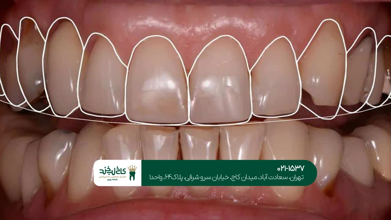 بهترین دندانپزشک برای طراحی لبخند در تهران بهترین دندانپزشک برای طراحی لبخند در تهران